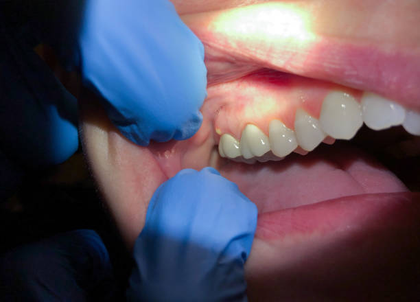 Best Emergency Broken Tooth Repair in Hanceville, AL