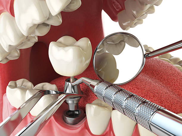 Best Walk-In Emergency Dentist in Hanceville, AL